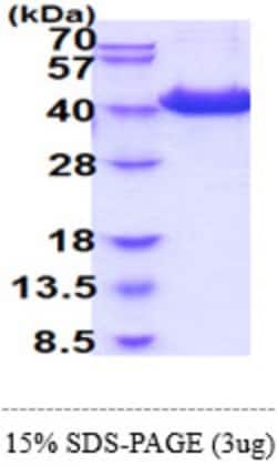 Novus Biologicals&trade;&nbsp;CD81 Recombinant Protein
